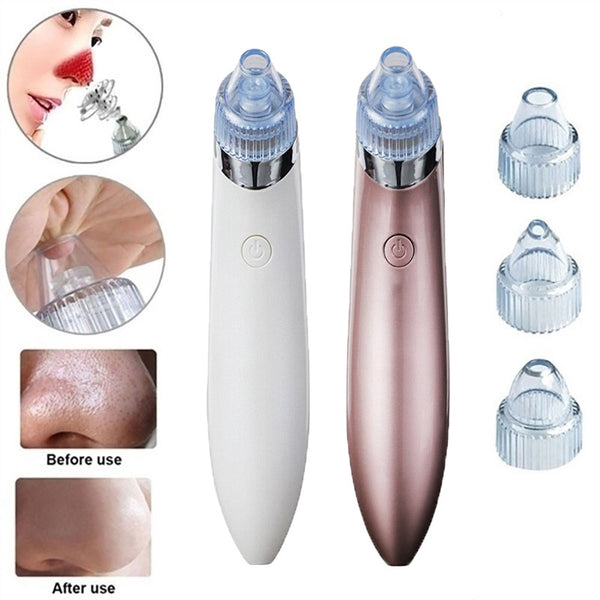 FACE ACNE & PORE CLEANER (FACE VACUUM)