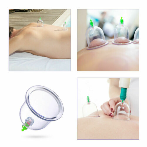 12 PCs CUPPING SET
