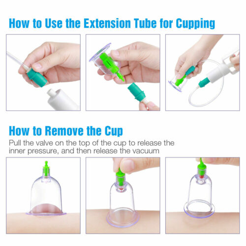 12 PCs CUPPING SET